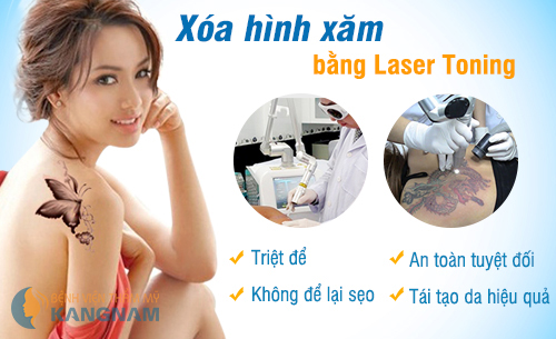 chi phi xoa xam laser toning plus tai bvtm kangnam