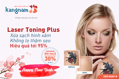 Happy New Year – BIGSALE 30% xóa xăm Laser Toning Plus tại BVTM Kangnam