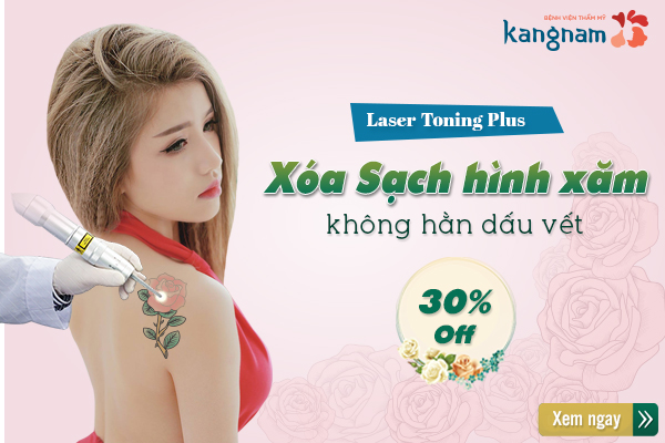 Khuyến mãi chào hè xóa bỏ hình xăm nhận ngay ưu đãi 30% – CN Laser Toning Plus