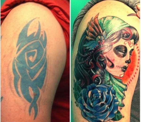 Những giải pháp khắc phục hình xăm bị hỏng